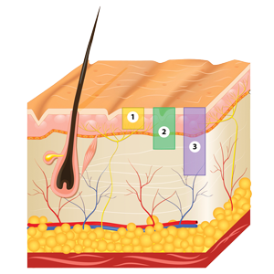 Chemical Peel How It Works Step 1